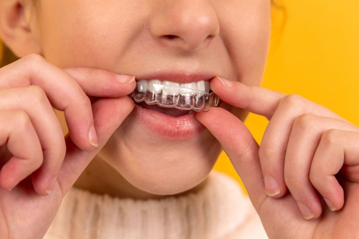 Cosmetic dental crowns